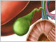 View medical illustration